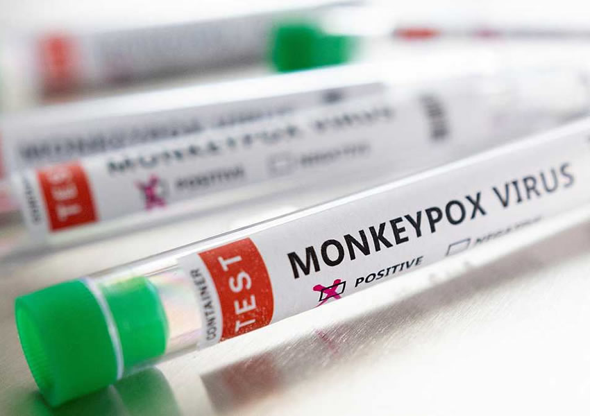 ¿Hasta dónde puede expandirse la viruela del mono? Los expertos descartan una nueva pandemia